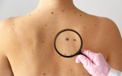 The Importance of Regular Skin Checks for Lasting Skin Health